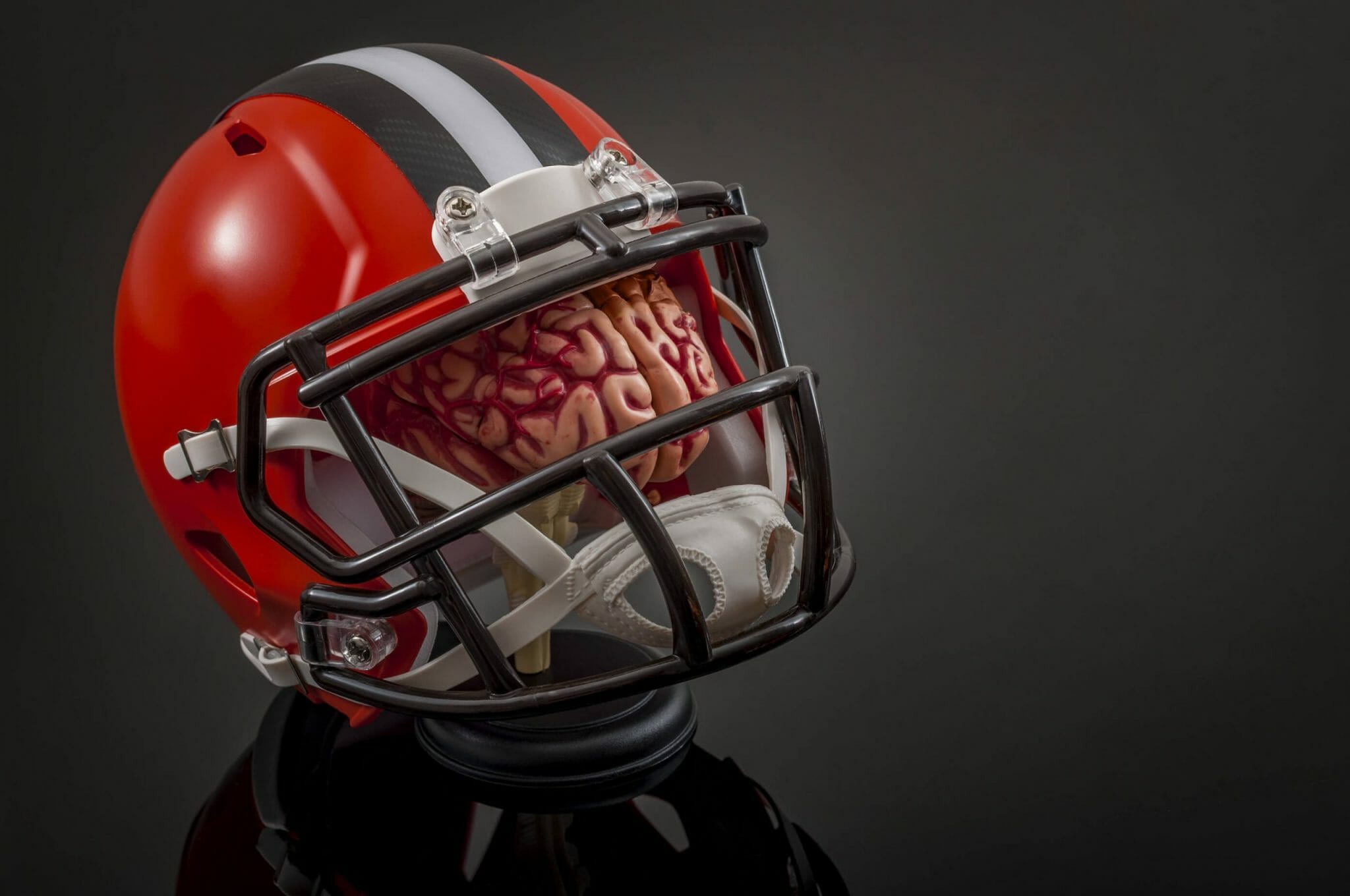 Concussion treatment airdrie