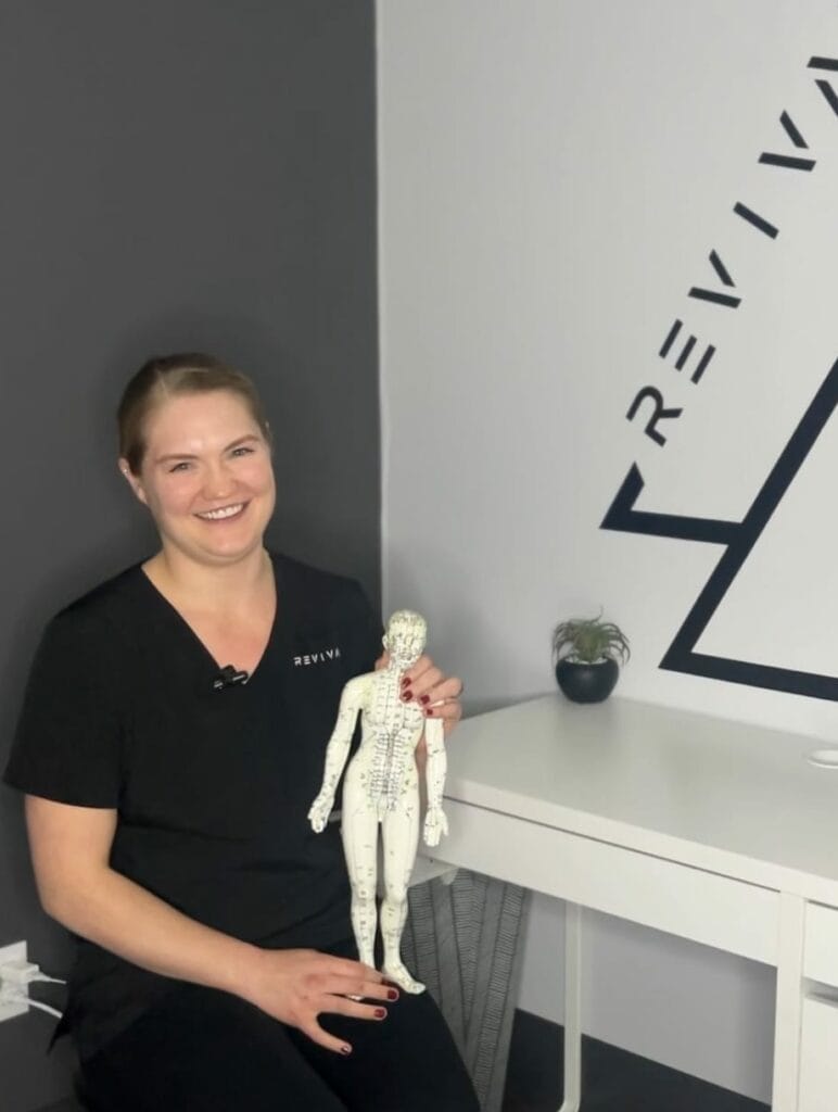 Acupuncture, Acupuncture near me, traditional Chinese medicine